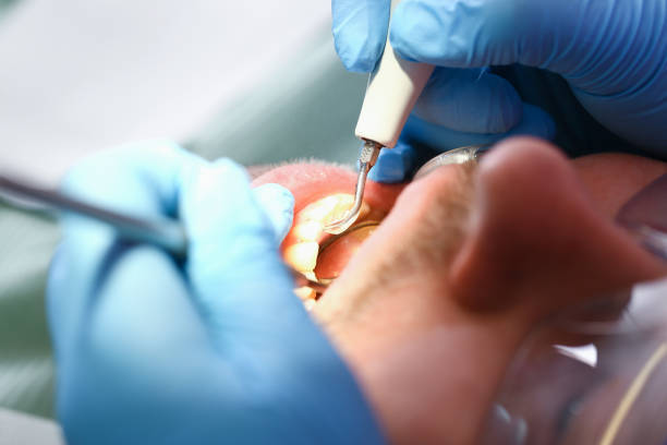 Best Emergency Dental Services for Seniors in Hudson Lake, IN