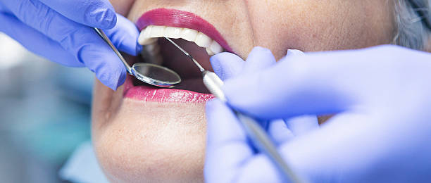 Best Emergency Root Canal Treatment in Hudson Lake, IN